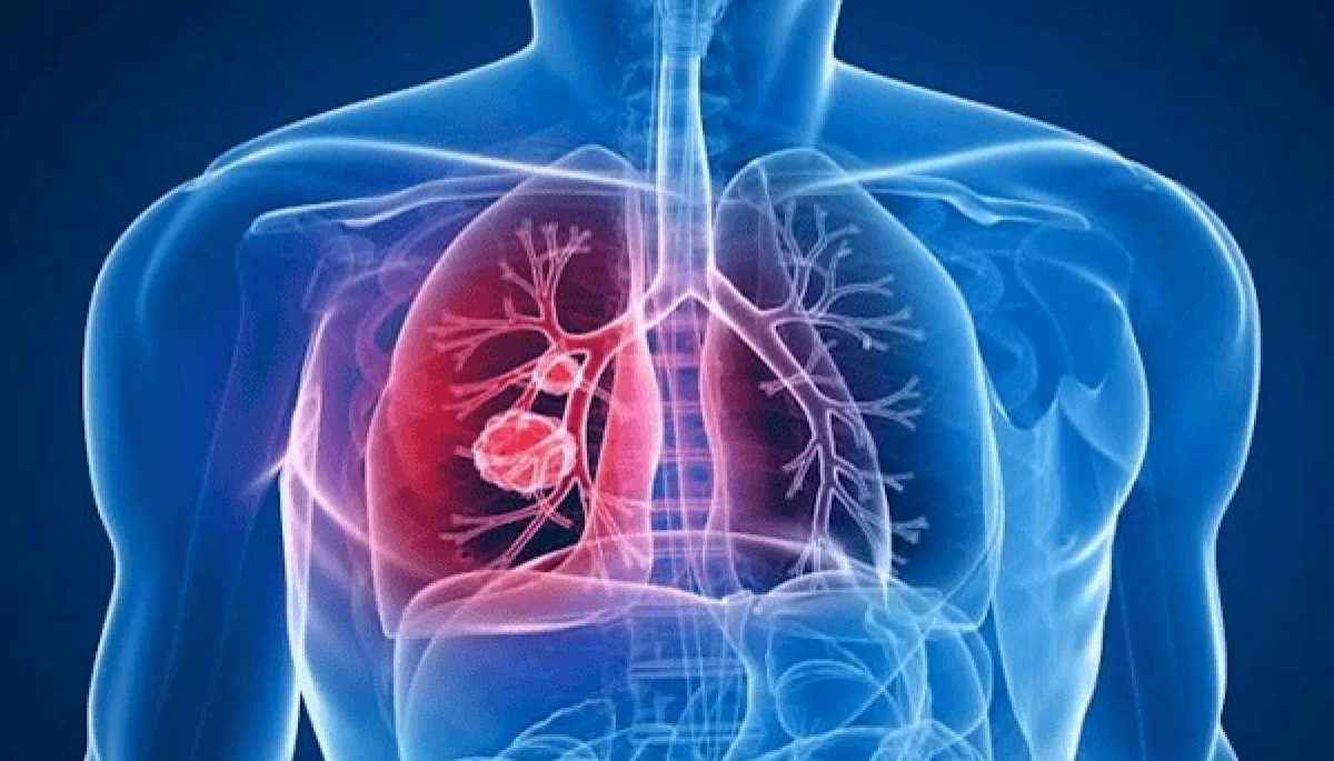 Foto: Reprodução/Internet